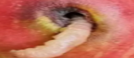 wurm